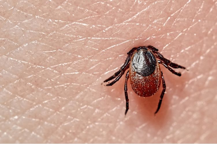 bệnh lyme